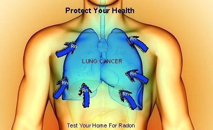 Graphic of how radon affects the lungs